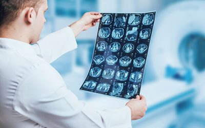 What Is HIE (Hypoxic Ischemic Encephalopathy)?