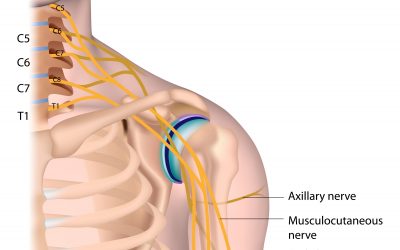 Shoulder Dystocia And Two Possible Injuries It Can Cause