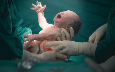 HIE Prognosis (Hypoxic Ischemic Encephalopathy)