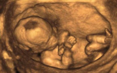 Umbilical Cord Is Delivered First! Can This Be Dangerous?
