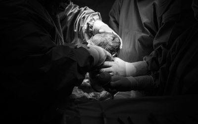 What Can Trigger The Need For An Emergency C-Section