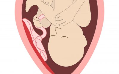 A Detached Placenta And HIE