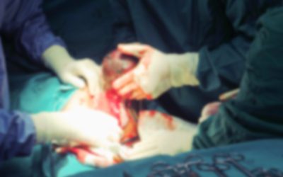 C-Section Delayed And An HIE Injury