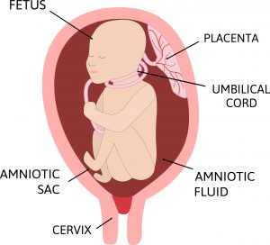 Umbilical Cord Around Neck During Pregnancy