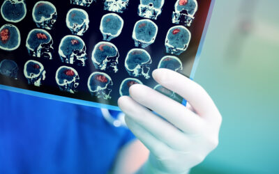 Are HIE Birth Injury Cases That Complex?