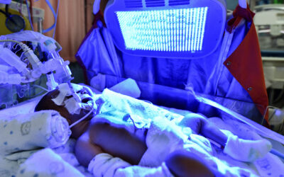 What If Baby Is Blue At Birth?