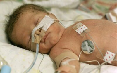 Baby’s Life Expectancy With An HIE Brain Injury
