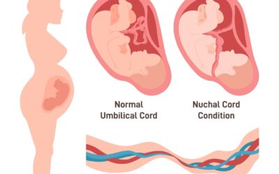 Safeguarding Your Baby’s Birth Journey From The Umbilical Cord Squeezed To An HIE Brain Injury