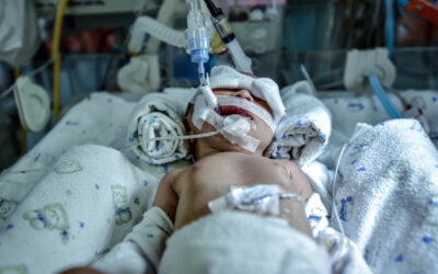 Your Baby’s Seizures At Birth And An HIE Brain Injury