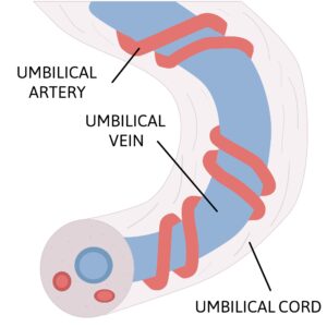 The hidden danger of umbilical cord compression during labor