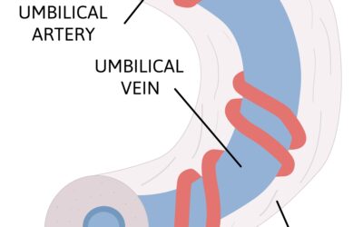 The Hidden Danger Of Umbilical Cord Compression During Labor