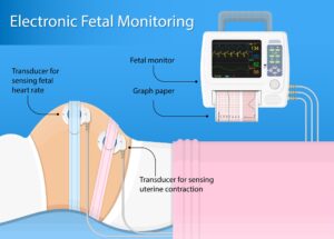 The strip that changed everything for the baby