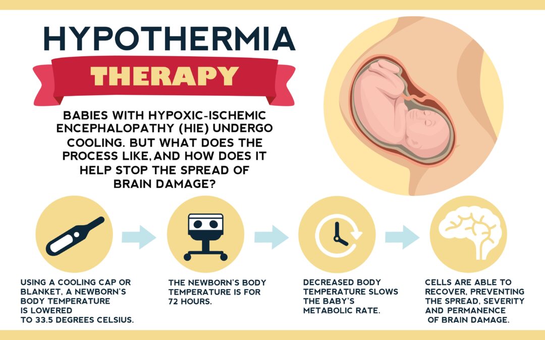 what doctors look for before starting a baby’s HIE cooling