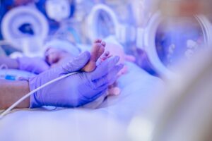 why do I see so many babies with cerebral palsy after an HIE diagnosis