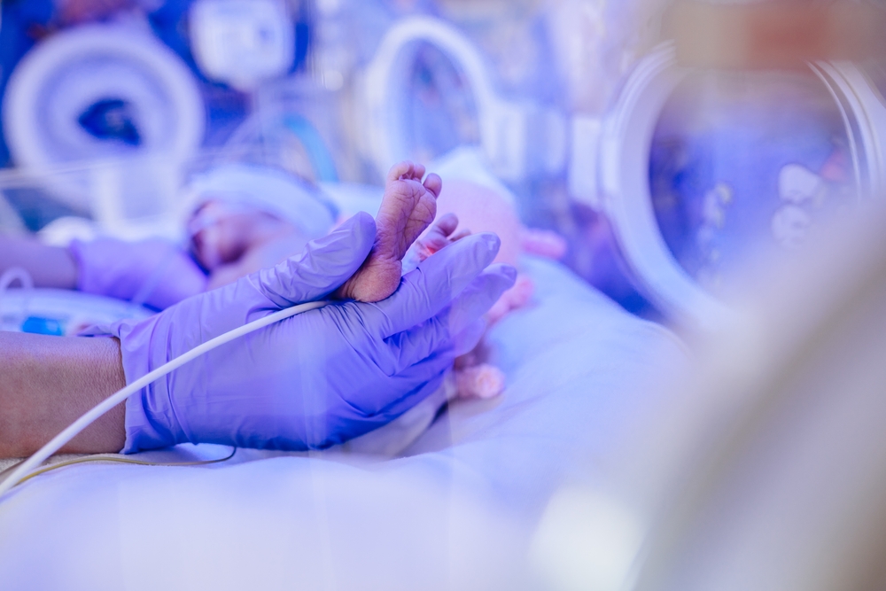 why do I see so many babies with cerebral palsy after an HIE diagnosis